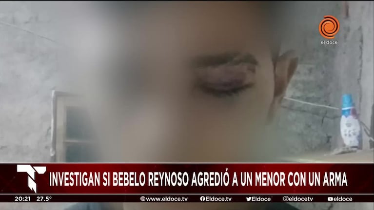 Habló la hermana del adolescente que denunció a Bebelo Reynoso