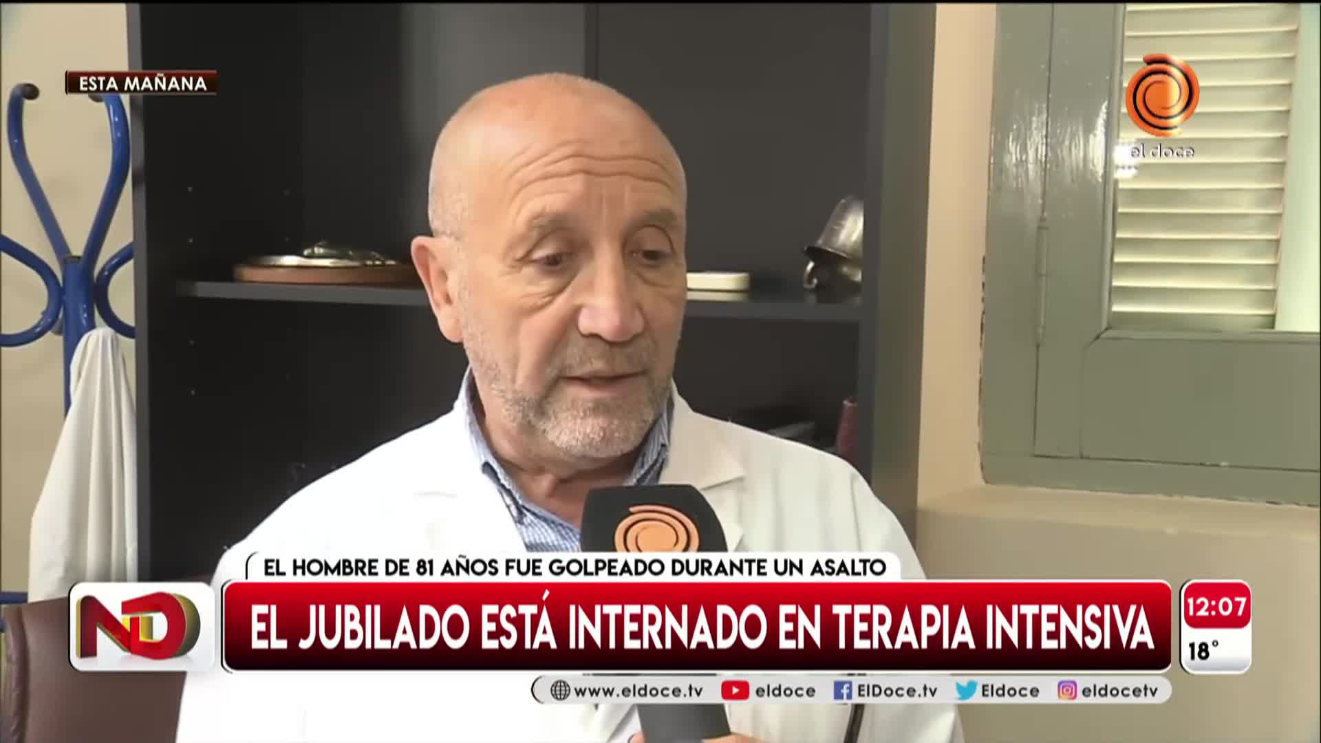 Brutal ataque a jubilado: le quebraron tres huesos de la cara