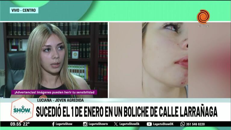 Luciana, la joven golpeada por un patovica