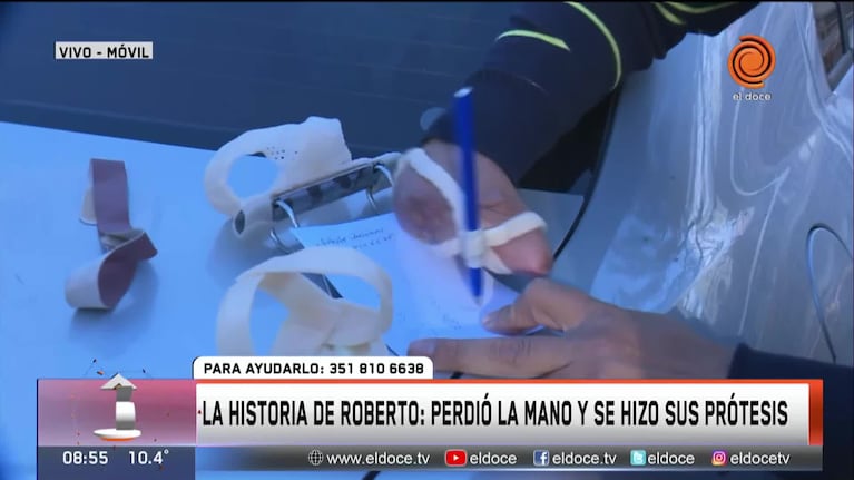 Perdió la mano y se hace sus propias prótesis