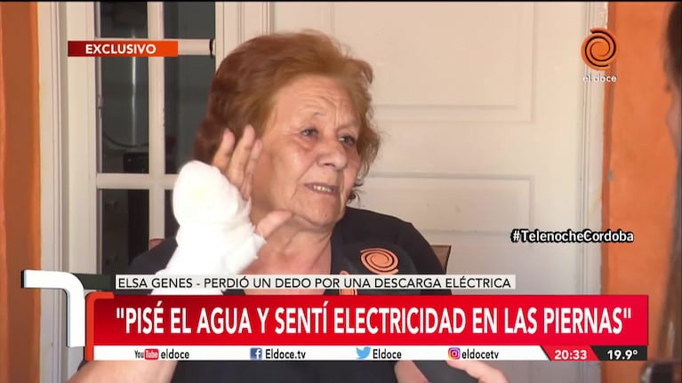 Habló Elsa, la mujer que se electrocutó y perdió un dedo