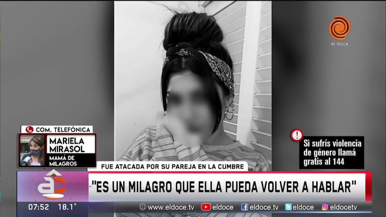 Pasó a sala común la joven brutalmente agredida por su novio