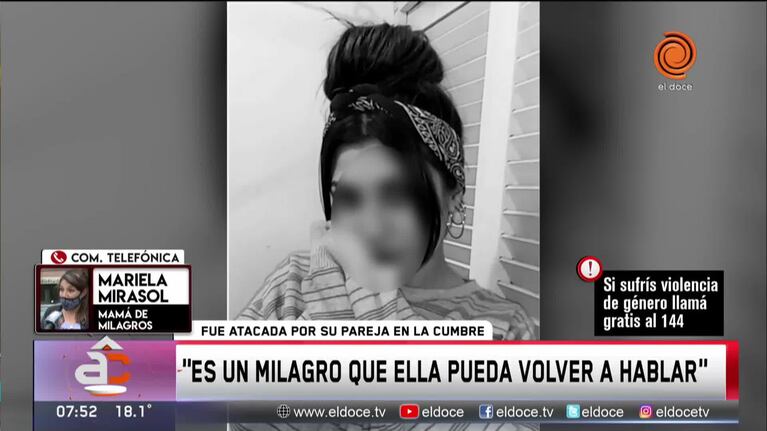 Pasó a sala común la joven brutalmente agredida por su novio