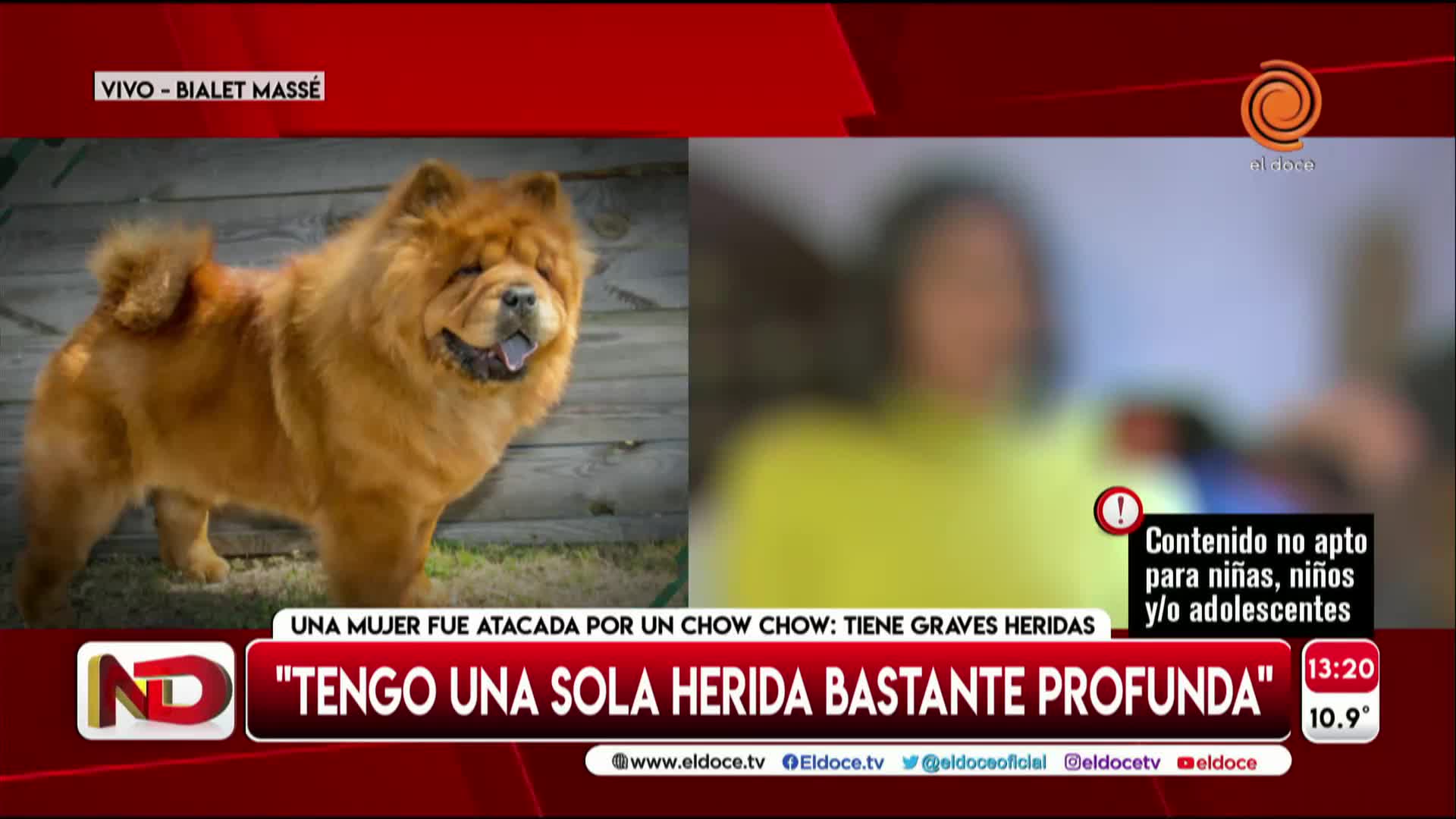 La víctima del chow chow contó cómo fue el ataque: “A un chico lo podría haber matado”