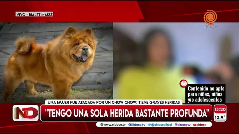 La víctima del chow chow contó cómo fue el ataque: “A un chico lo podría haber matado”