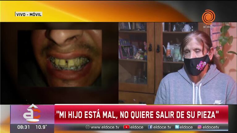 Tenía $100 y un celular viejo: le destrozaron la mandíbula para robarle