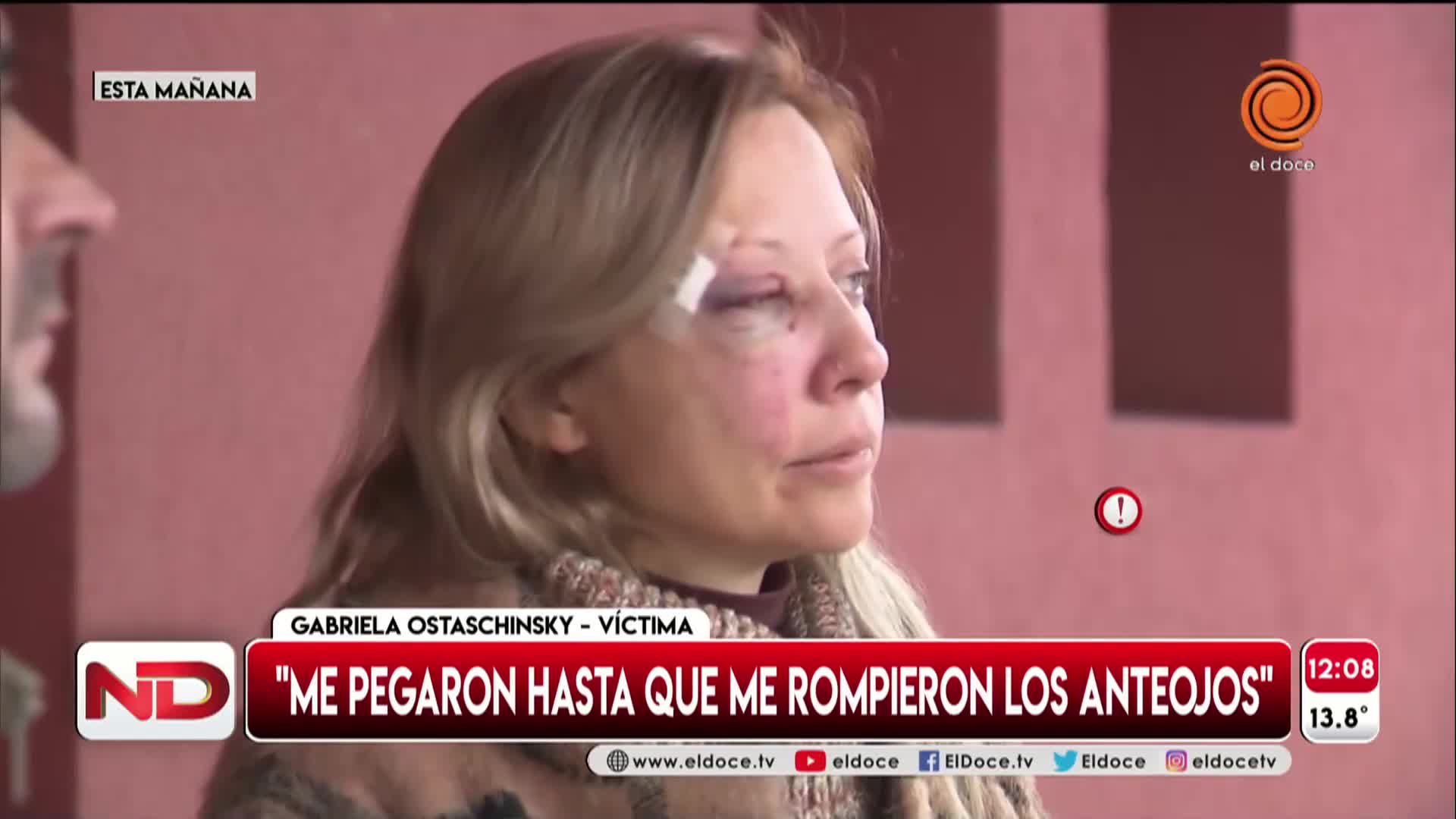 Alta Gracia: ladrones golpearon a una embarazada