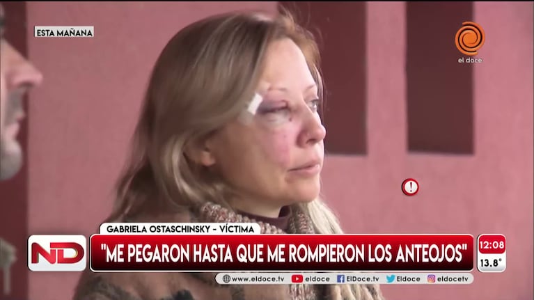 Alta Gracia: ladrones golpearon a una embarazada