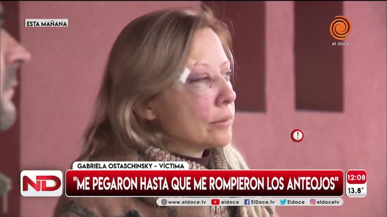 Alta Gracia: ladrones golpearon a una embarazada