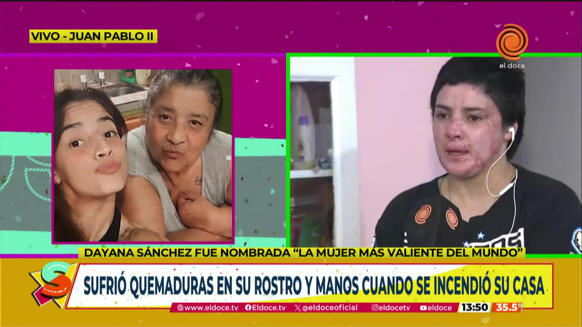 Dayana Sánchez y su pelea por sobrevivir al fuego