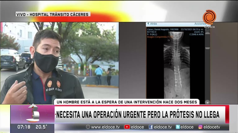 Necesita operarse urgente: espera una prótesis hace dos meses