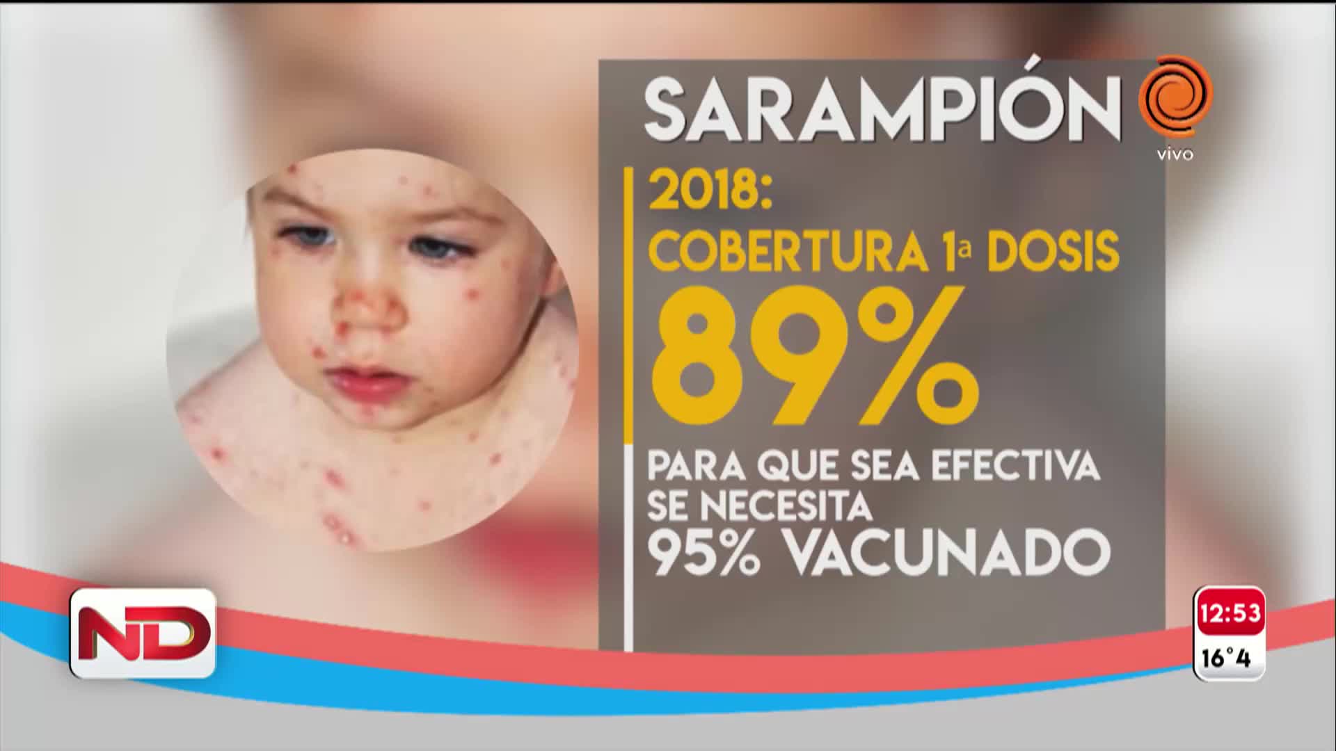 Alerta por el sarampión: la importancia de las vacunas