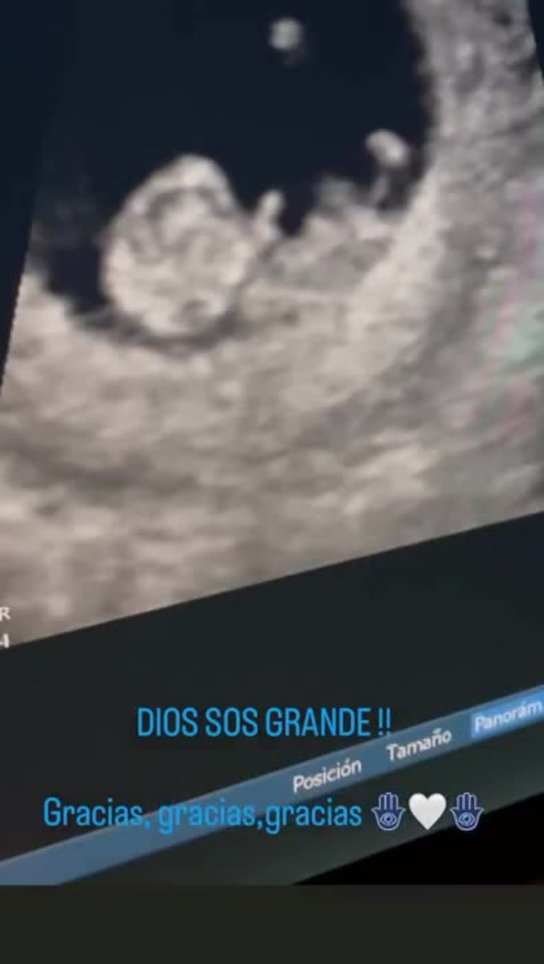 Video Placeholder