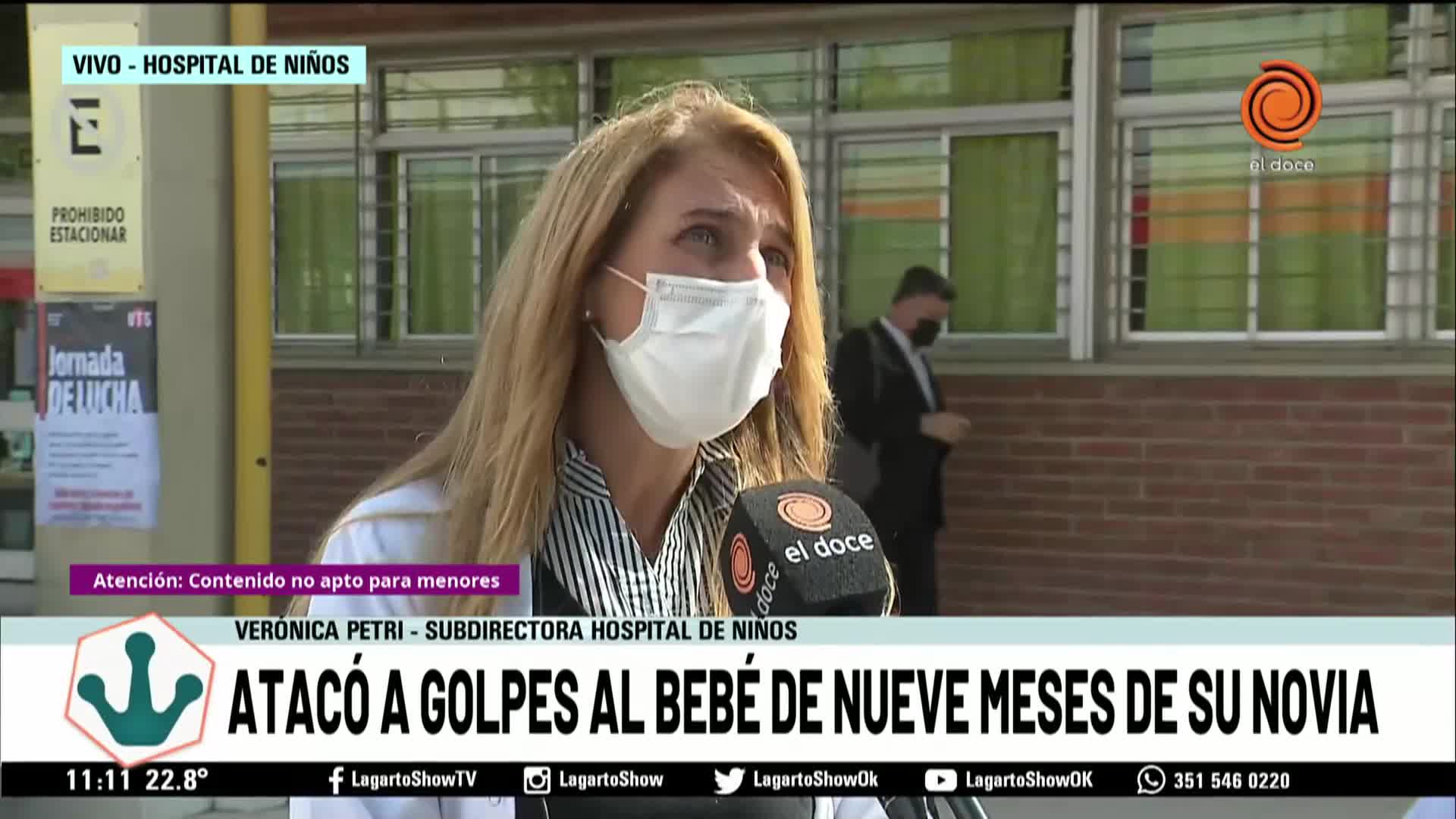 El bebé golpeado tiene hematomas en el cráneo, cuello y espalda