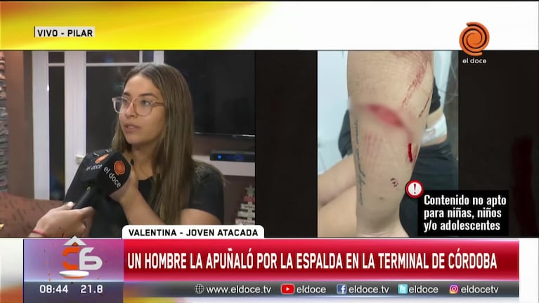 El relato de la joven apuñalada en la Terminal: “No se si quiero volver a Córdoba”