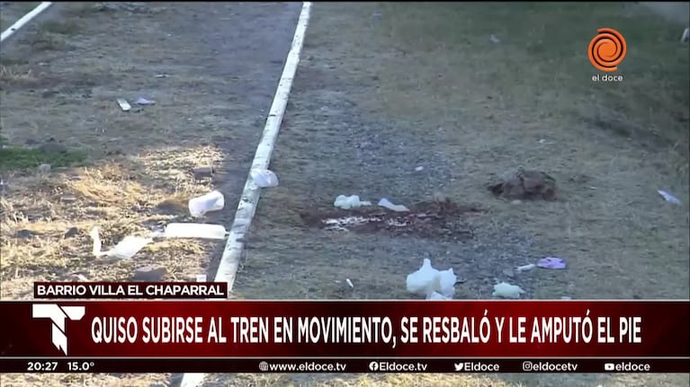 Gravísimo accidente con un tren en Córdoba: un chico sufrió la amputación de un pie