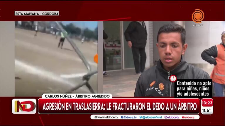 Agredieron a un árbitro y le fracturaron un dedo en Traslasierra