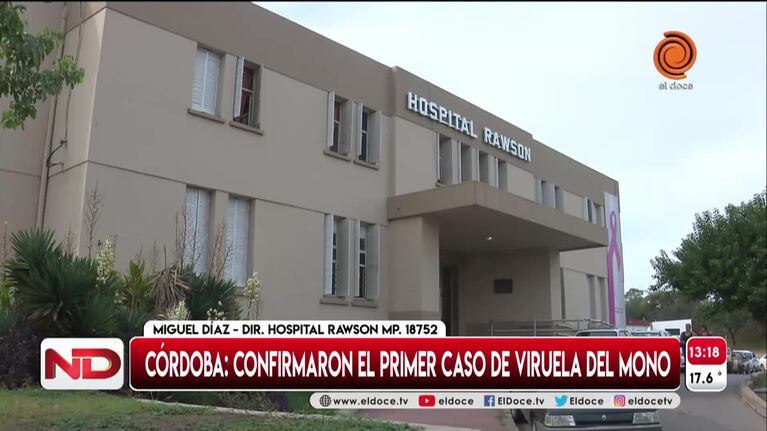 El primer paciente con viruela del mono en Córdoba se aisló de forma voluntaria