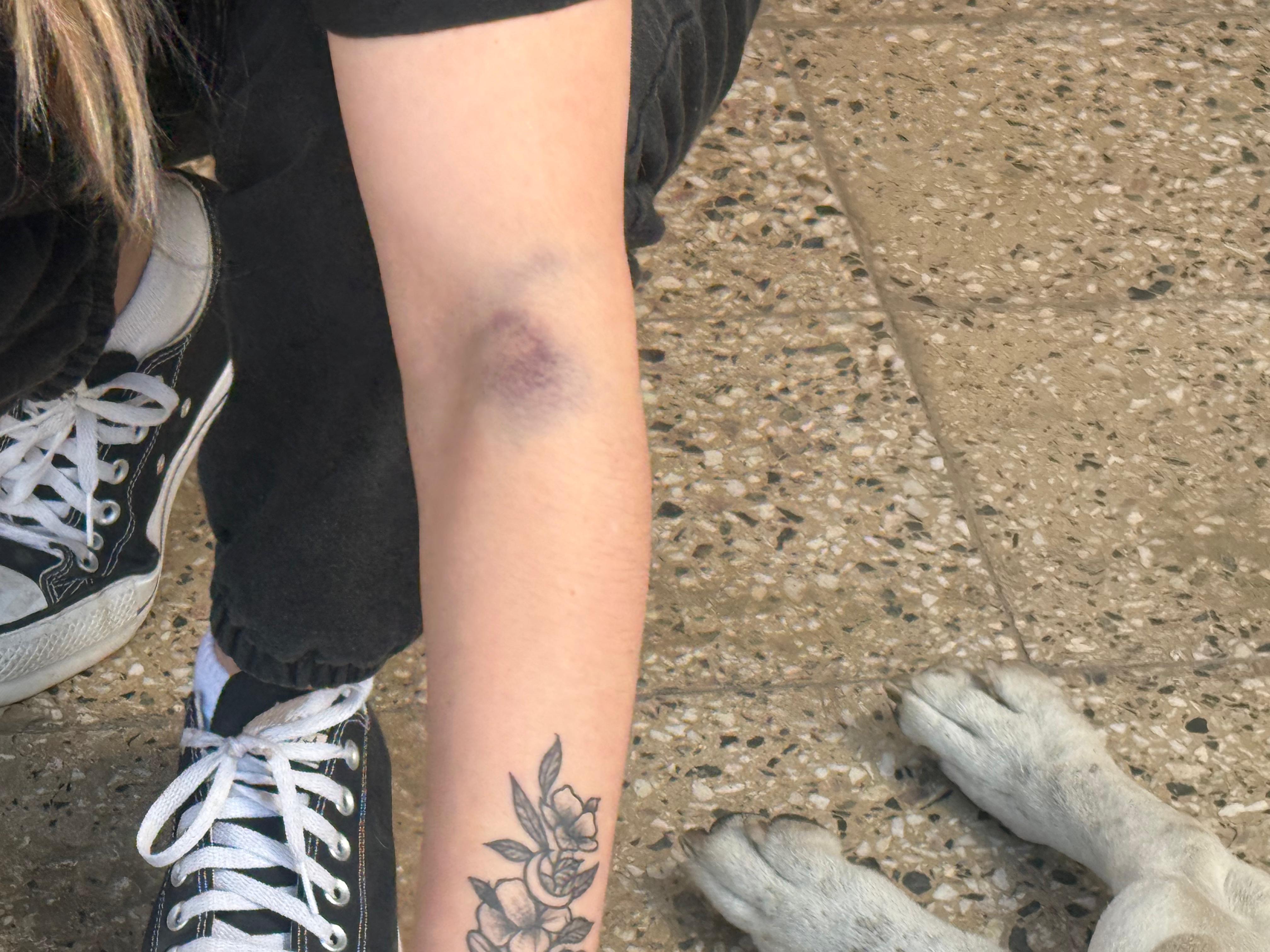 Los dramáticos minutos que vivió la mujer salvada por su perro de un robo