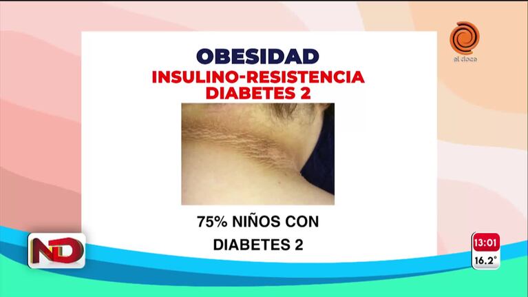 Acantosis, una alerta por diabetes: cómo detectarla en la piel