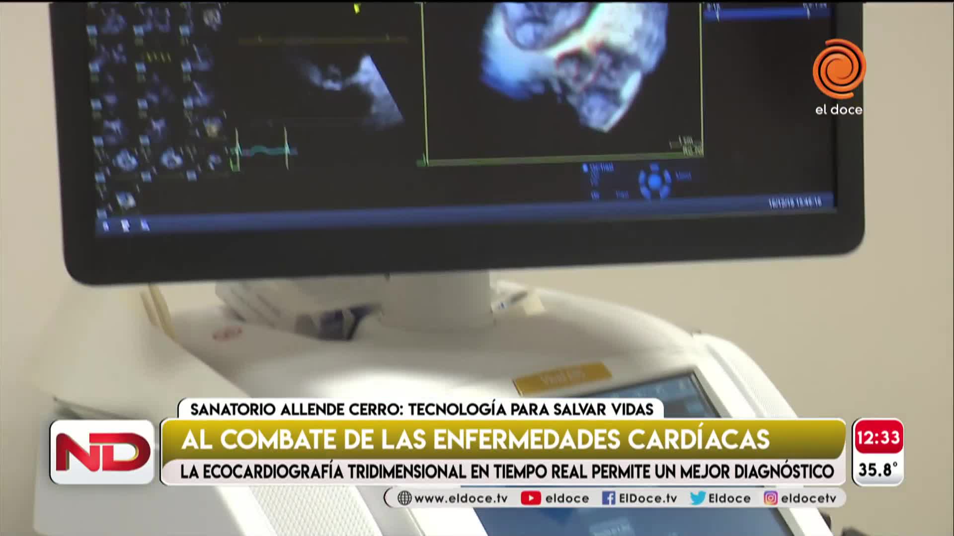 Ecocardiografías 3D: tecnología para salvar vidas