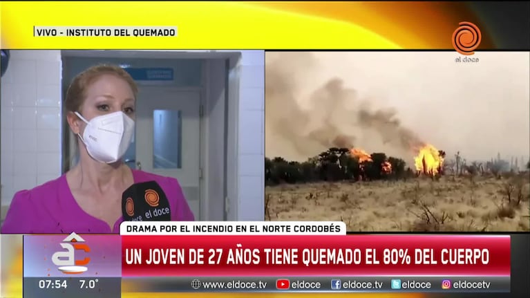 Incendio en Córdoba: la salud del joven con el 80% del cuerpo quemado