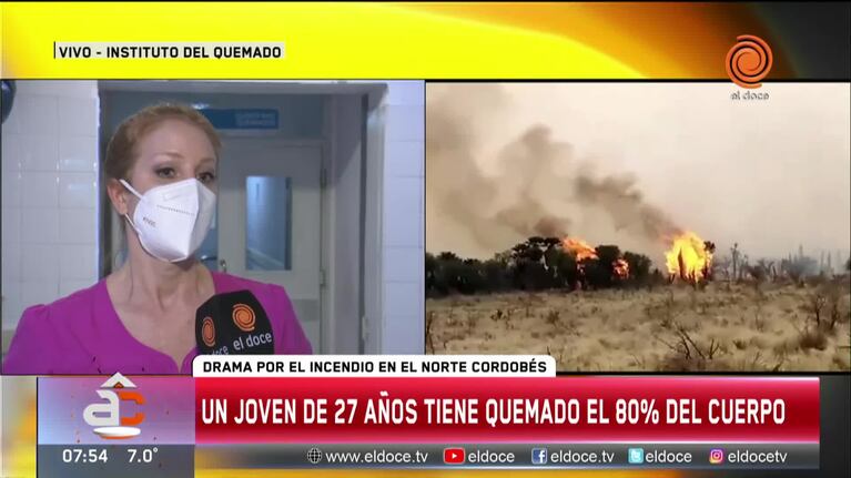 Incendio en Córdoba: la salud del joven con el 80% del cuerpo quemado