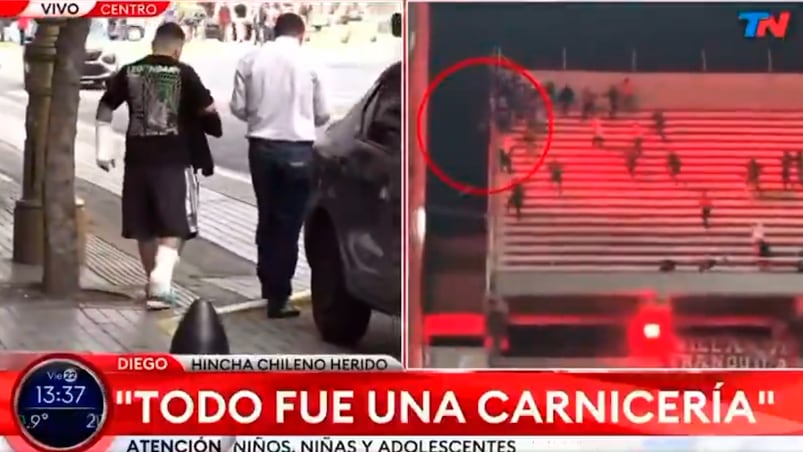 hincha lesionado chile