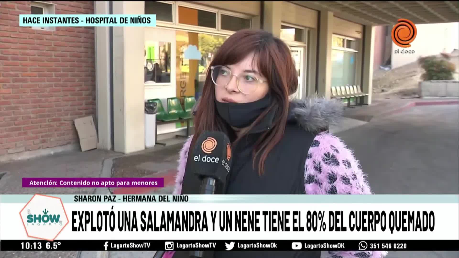 La hermana del nene quemado contó cómo fue el hecho