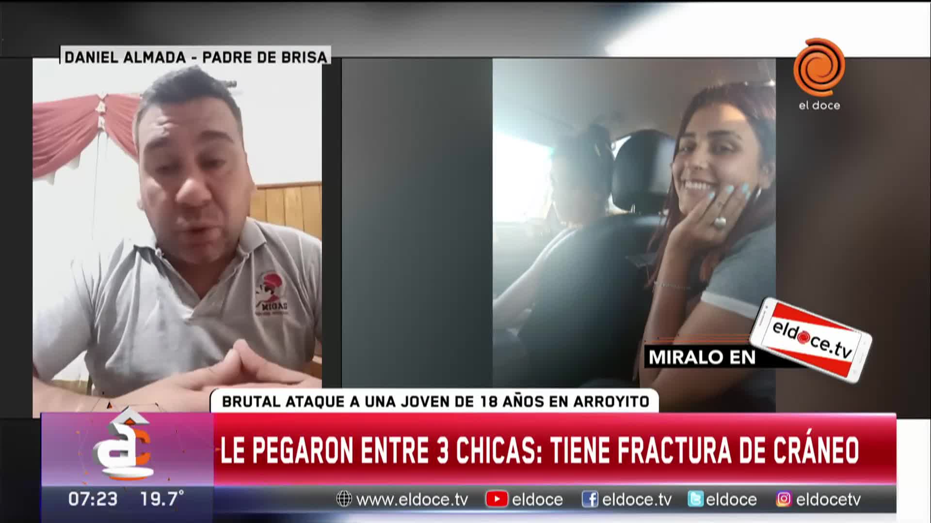 Brutal ataque a una chica en Arroyito: "Le dieron patadas en la cabeza"