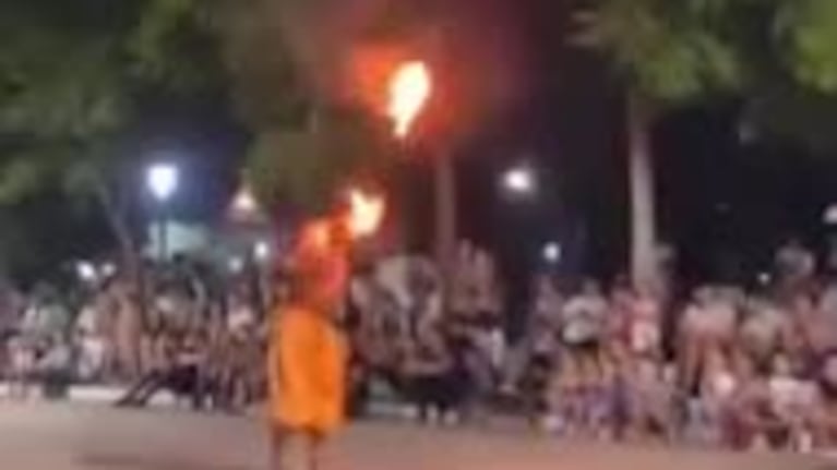 Hizo un truco en los carnavales y casi se quemó la cabeza