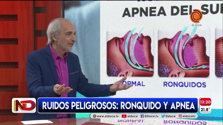 Ronquidos y apneas del sueño: las consecuencias para la salud