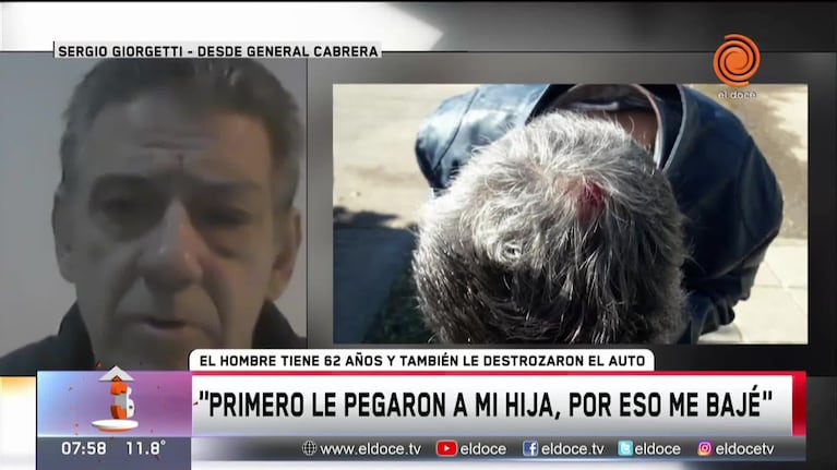 Brutal ataque en patota a un abuelo en General Cabrera