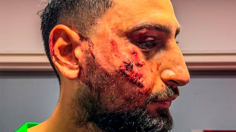 El patadón que le rompió la cara a Donnarumma en el PSG