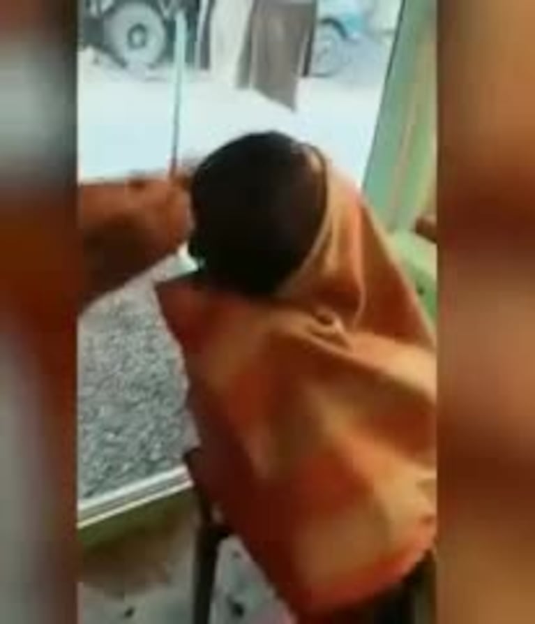 Quiso cortarse el pelo con fuego y se quemó la cabeza