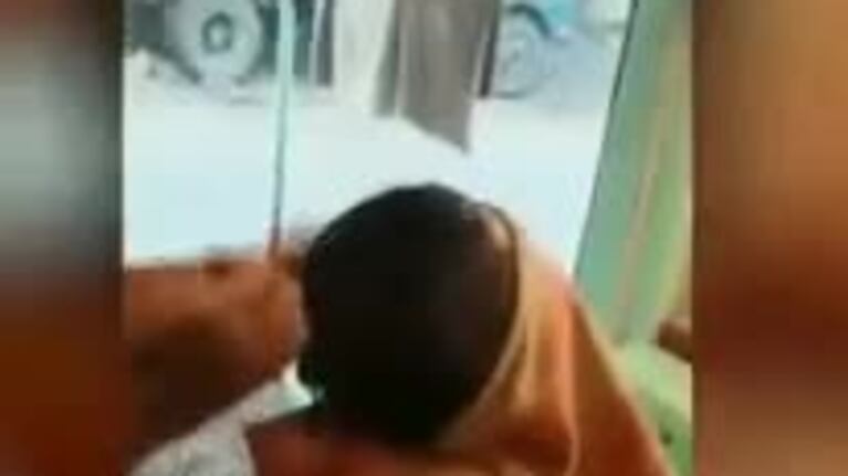 Quiso cortarse el pelo con fuego y se quemó la cabeza