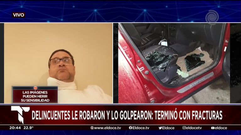 Paramédico del Misericordia asaltado: "Me golpearon la cabeza contra el piso para robarme”