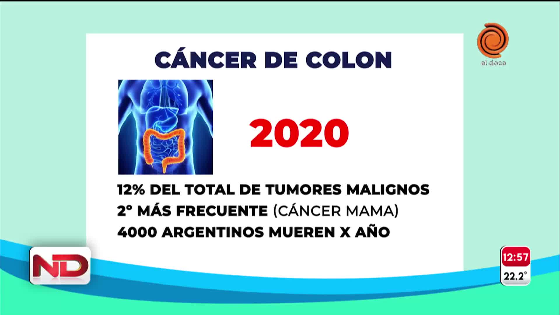 Comenzó la Campaña de Prevención contra el Cáncer de colon en el Buen Pastor