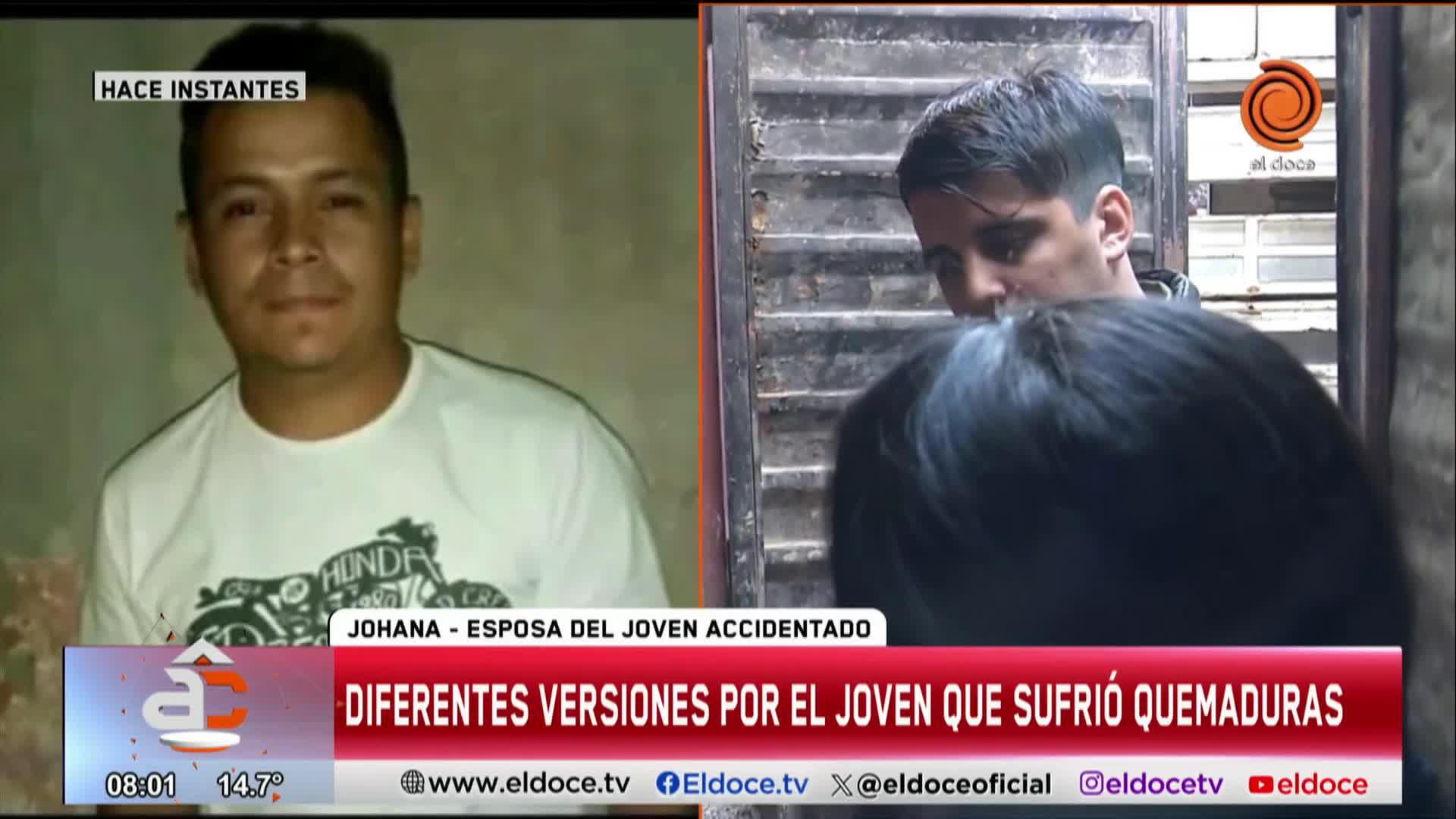 Sigue internado el joven que se quemó la mitad del cuerpo