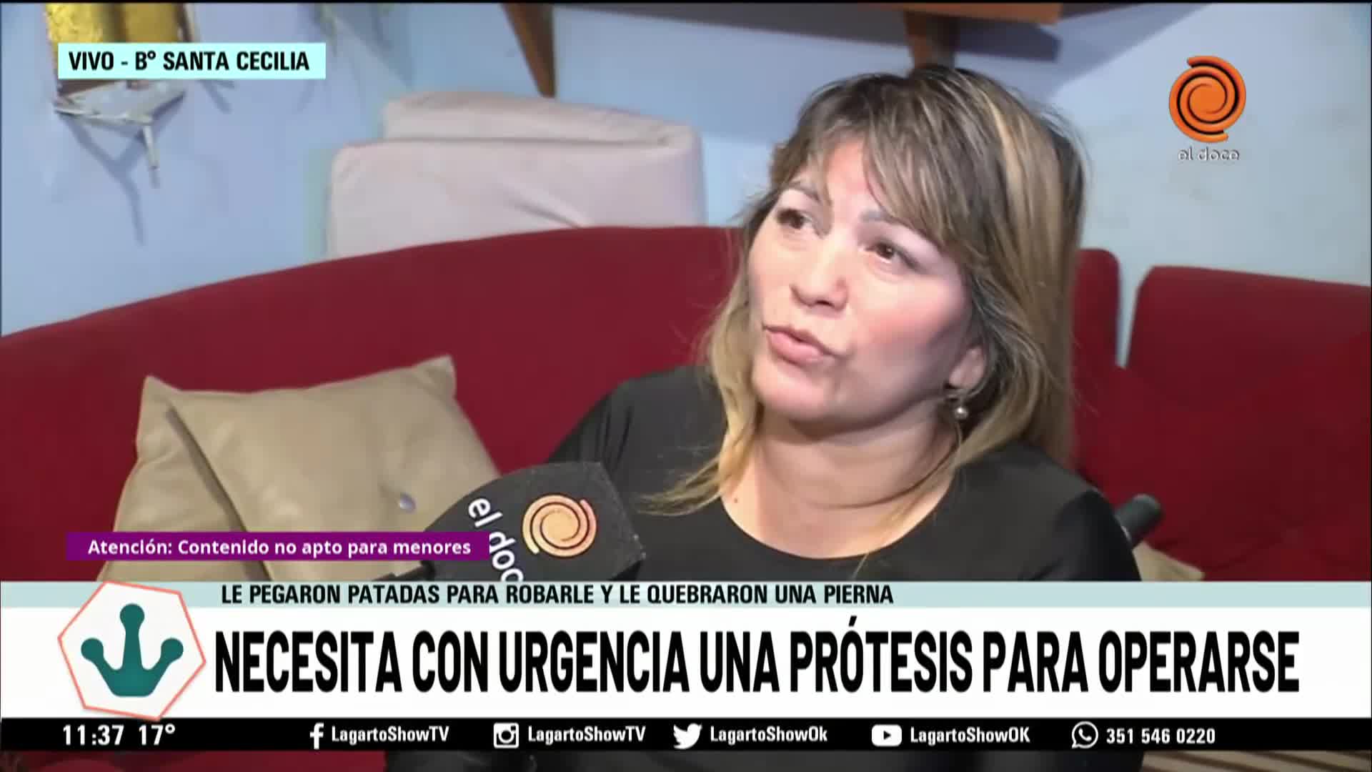 La atacaron para robarle y le quebraron la pierna