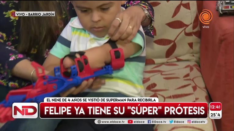 Felipe y su "súper" prótesis 3D