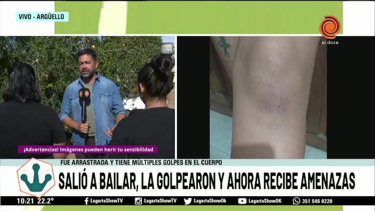 Denunció que otra joven la golpeó en el boliche