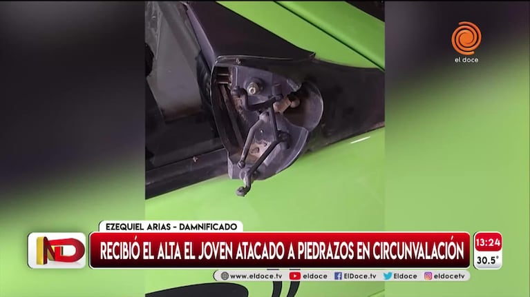 El joven atacado a piedrazos: "No me acuerdo de nada"