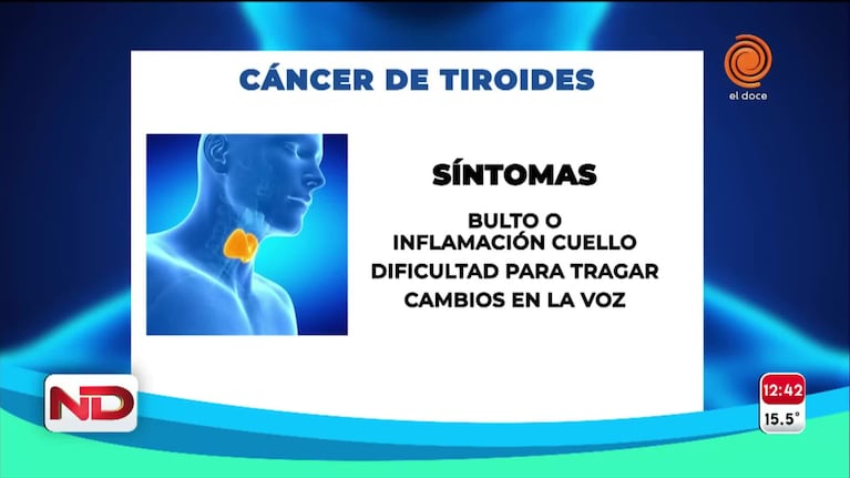 Cuáles son los síntomas del cáncer de tiroides