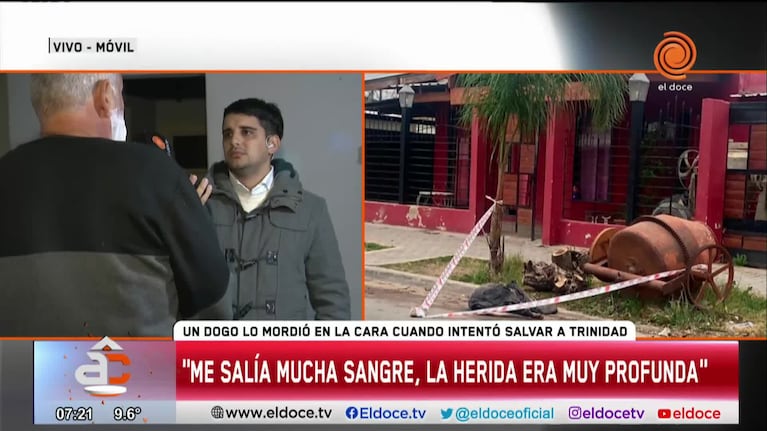 Así le quedó el rostro al hombre que intentó salvar a la chica de los dogos