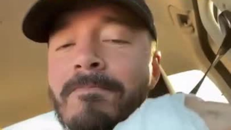 J Balvin mostró el resultado de su accidente