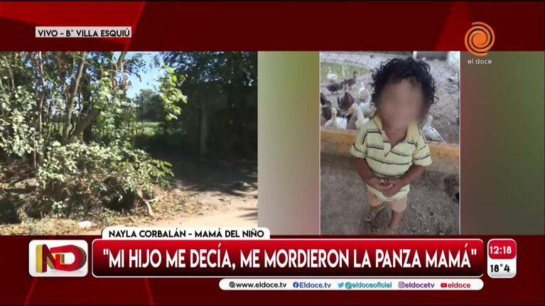 Un niño de tres años fue atacado por una jauría