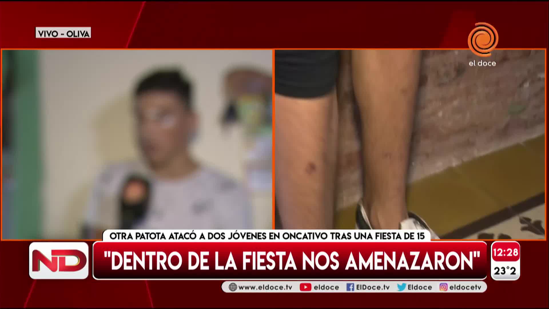 Dos adolescentes fueron atacados a la salida de un cumple de 15