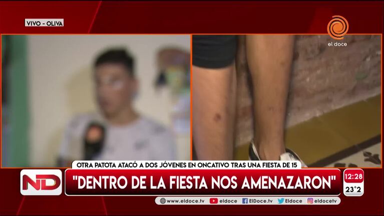 Dos adolescentes fueron atacados a la salida de un cumple de 15