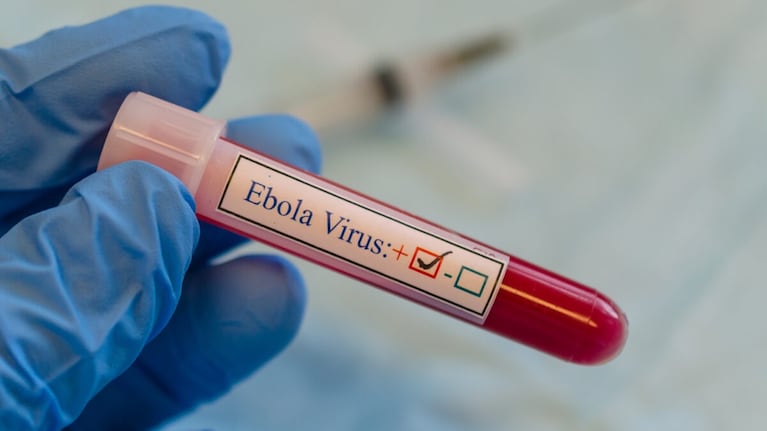 Brote de ébola: qué es y cómo se contagia